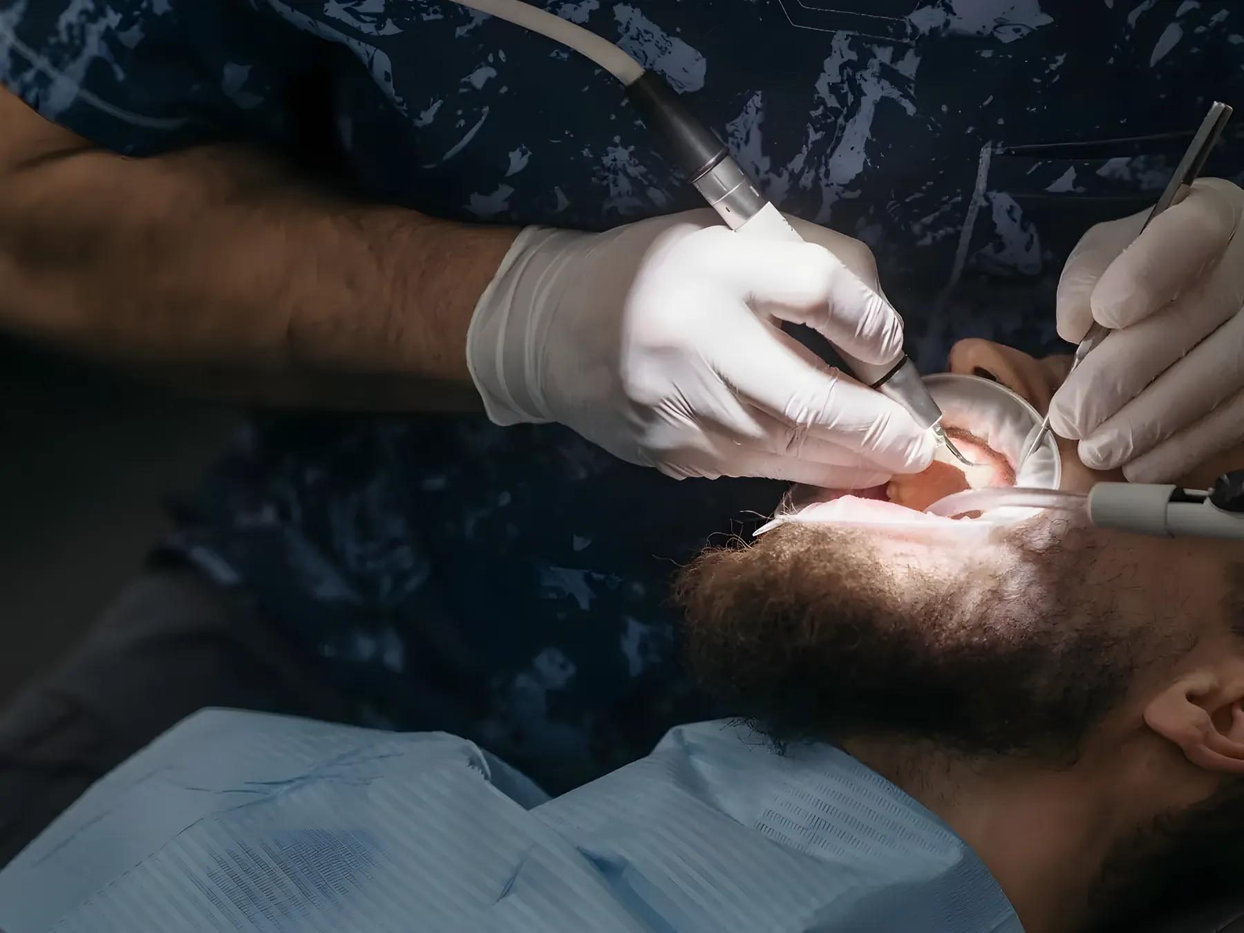 Dentist professionally cleaning a patient's teeth
