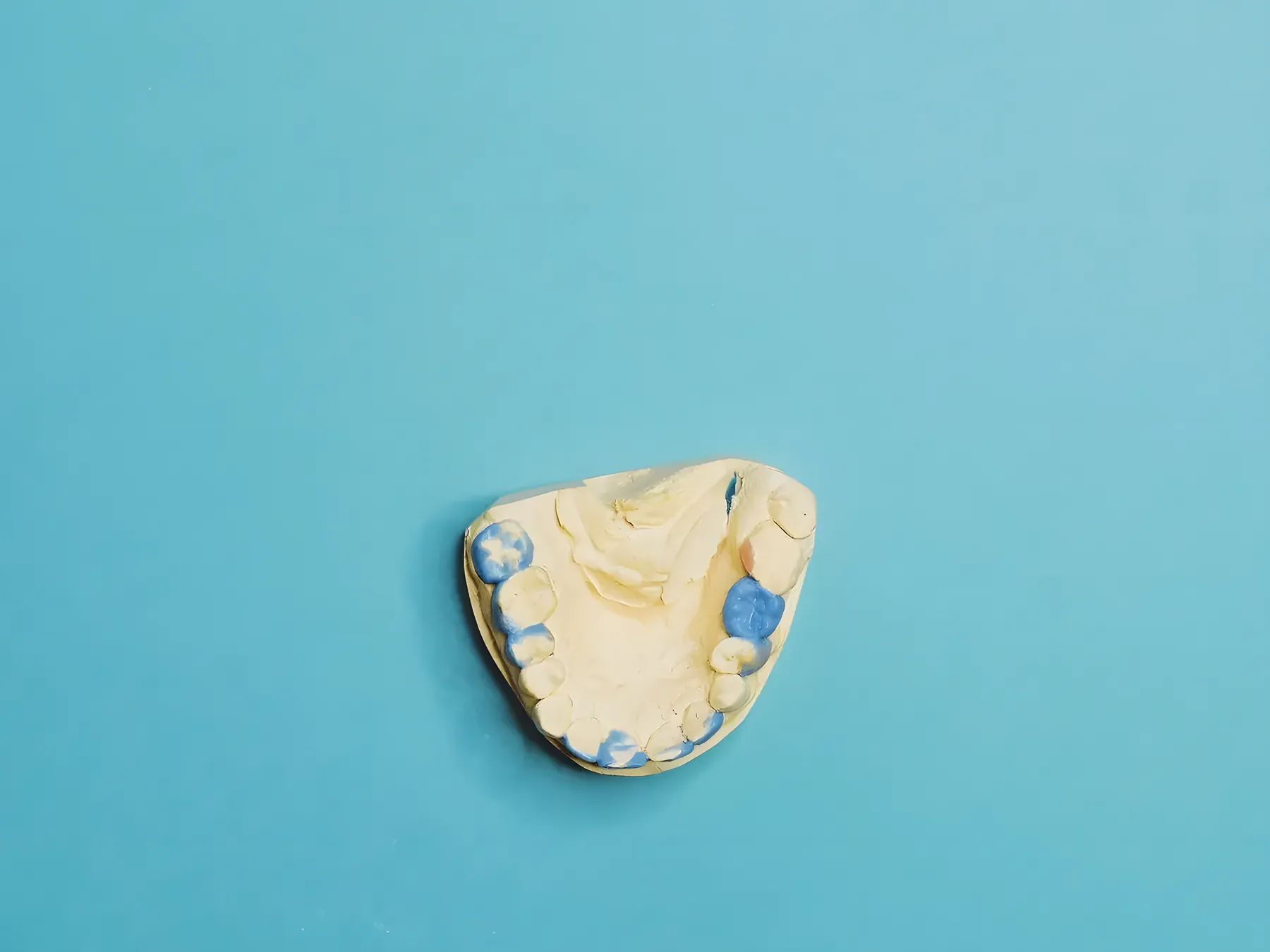 Close-up of a dental denture in a gloved hand