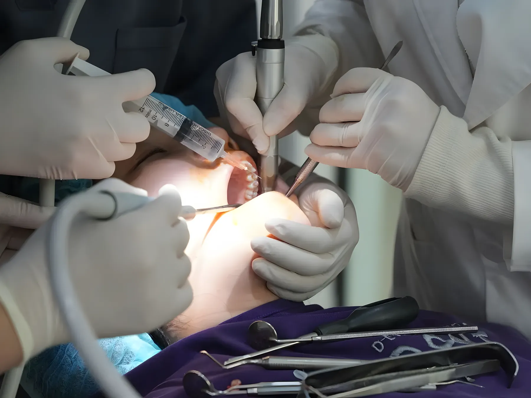 Surgeons performing a careful oral surgical procedure